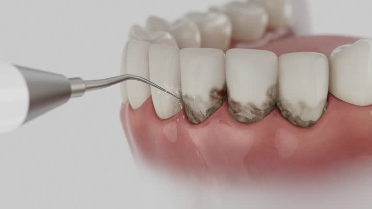 Trusted Invisalign Clear Aligners service in Double Springs, AL - Dentist Open Now